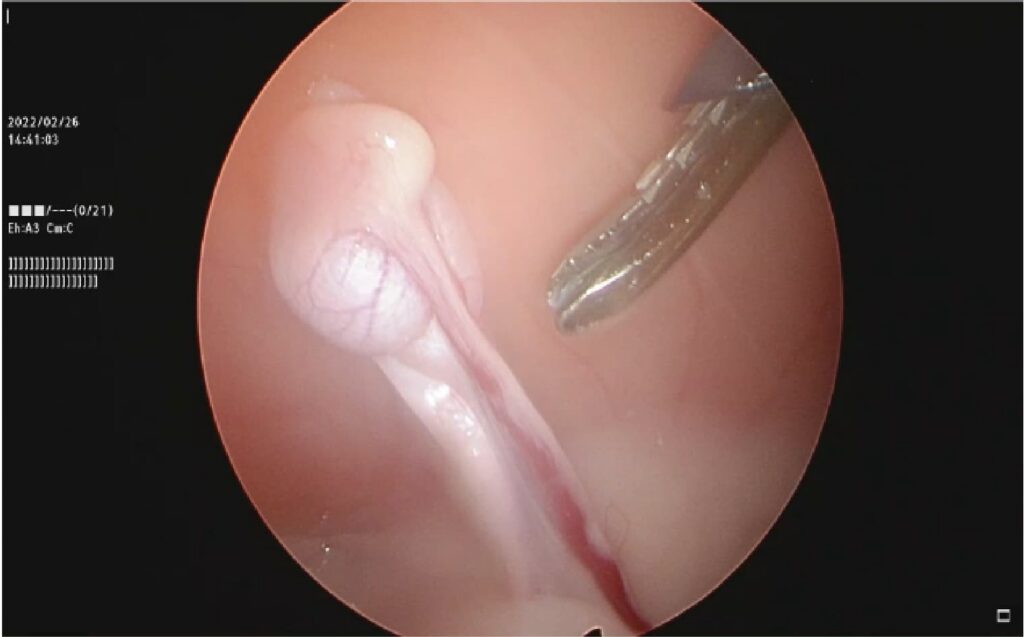 手術中のモニター映像
